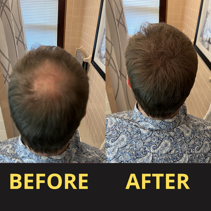 Waterproof Hair Concealer for Fuller-Looking Hair – Natural Scalp Coverage
