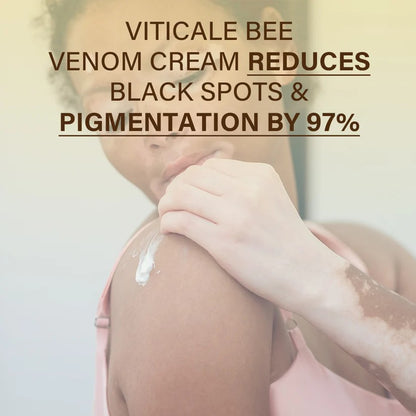 VitiClear Bee Venom Cream – Natural Pigment Balancing Skin Cream