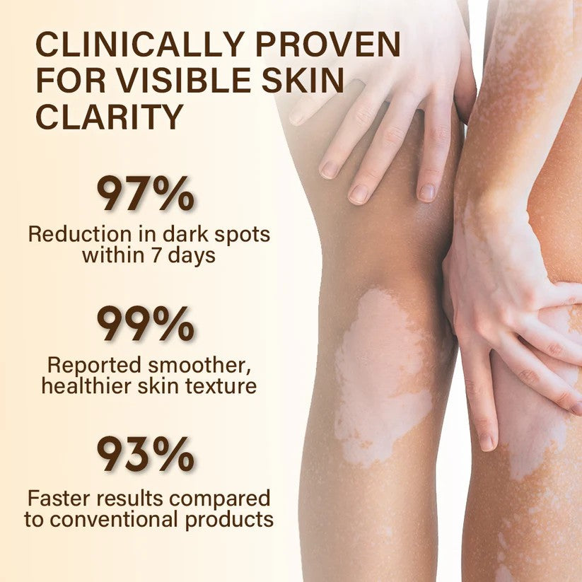 VitiClear Bee Venom Cream – Natural Pigment Balancing Skin Cream