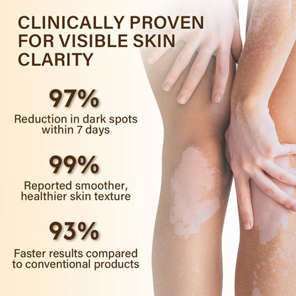 VitiClear Bee Venom Cream – Natural Pigment Balancing Skin Cream