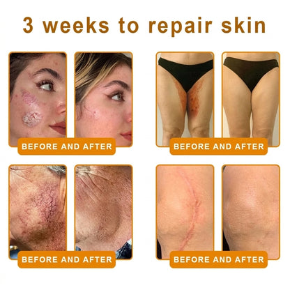 Bee Venom Skin Firming & Hydrating Cream – Anti-Aging Peptide Moisturizer for Smoother Skin