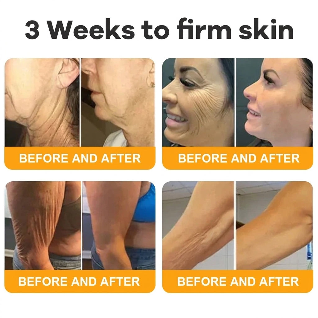 Bee Venom Skin Firming & Hydrating Cream – Anti-Aging Peptide Moisturizer for Smoother Skin