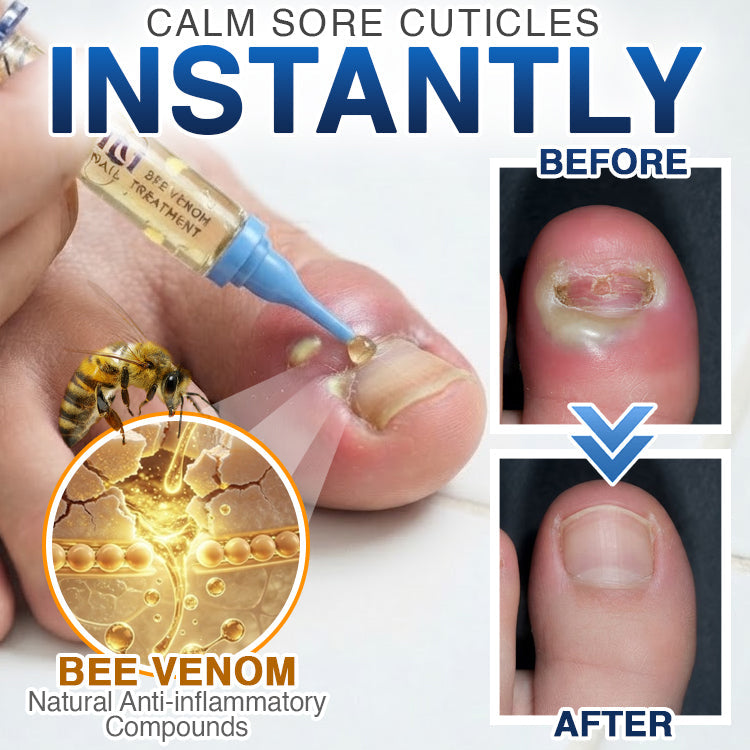 FungiFree Bee Venom Nail Treatment 🐝  Natural Nail & Cuticle Conditioning Care