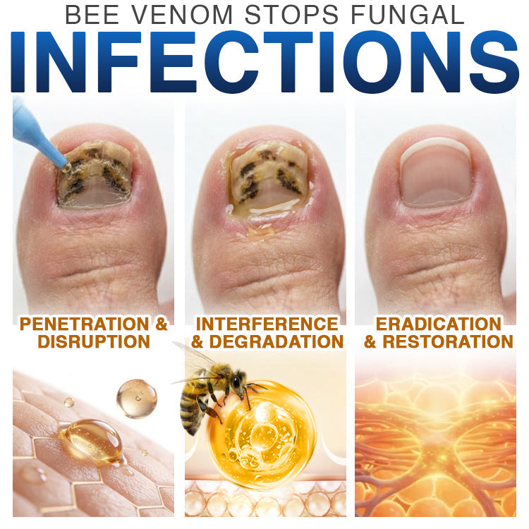 FungiFree Bee Venom Nail Treatment 🐝  Natural Nail & Cuticle Conditioning Care