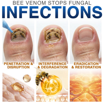 FungiFree Bee Venom Nail Treatment 🐝  Natural Nail & Cuticle Conditioning Care