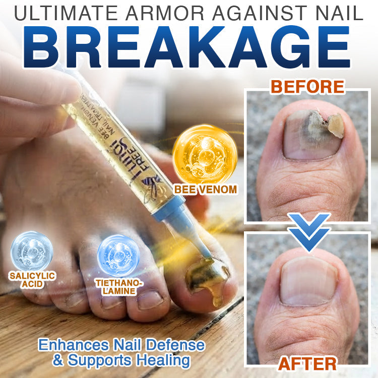 FungiFree Bee Venom Nail Treatment 🐝  Natural Nail & Cuticle Conditioning Care