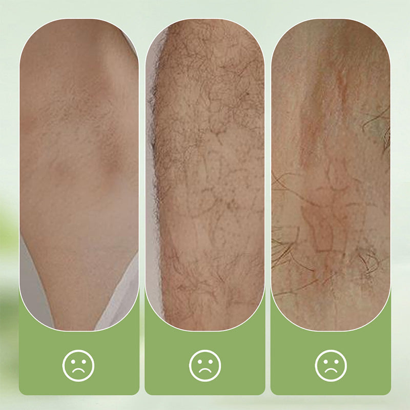 Gentle and Non-Irritating Hair Removal Cream